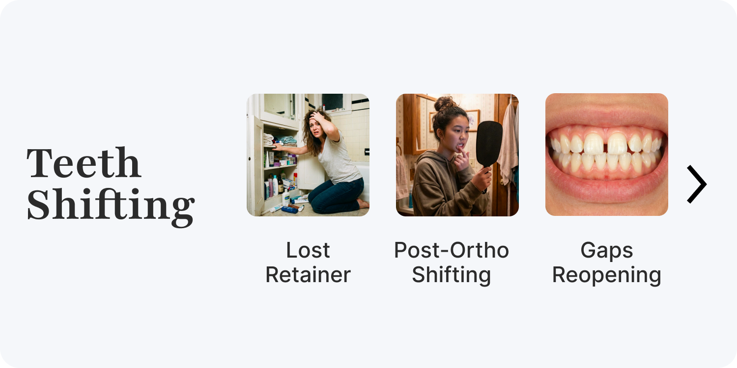 Teeth Shifting